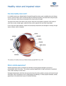 Healthy vision and impaired vision How does healthy vision work