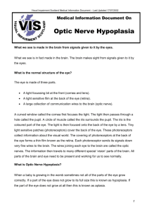Optic Nerve Hypoplasia - Visual Impairment Network Children