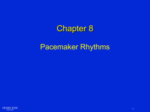 Pacemaker