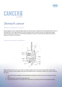 Stomach cancer - Cancerinfo.co.nz