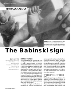 The Babinski sign - Practical Neurology