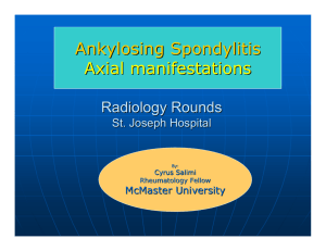 Ankylosing Spondylitis Axial manifestations
