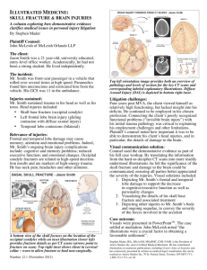 Illustrated Medicine: Skull Fracture and Brain