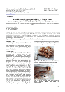 Broad Ligament Leiomyoma Mimicking As Ovarian