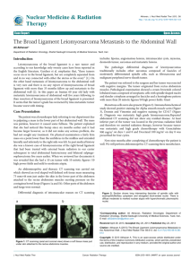 The Broad Ligament Leiomyosarcoma Metastasis to the Abdominal