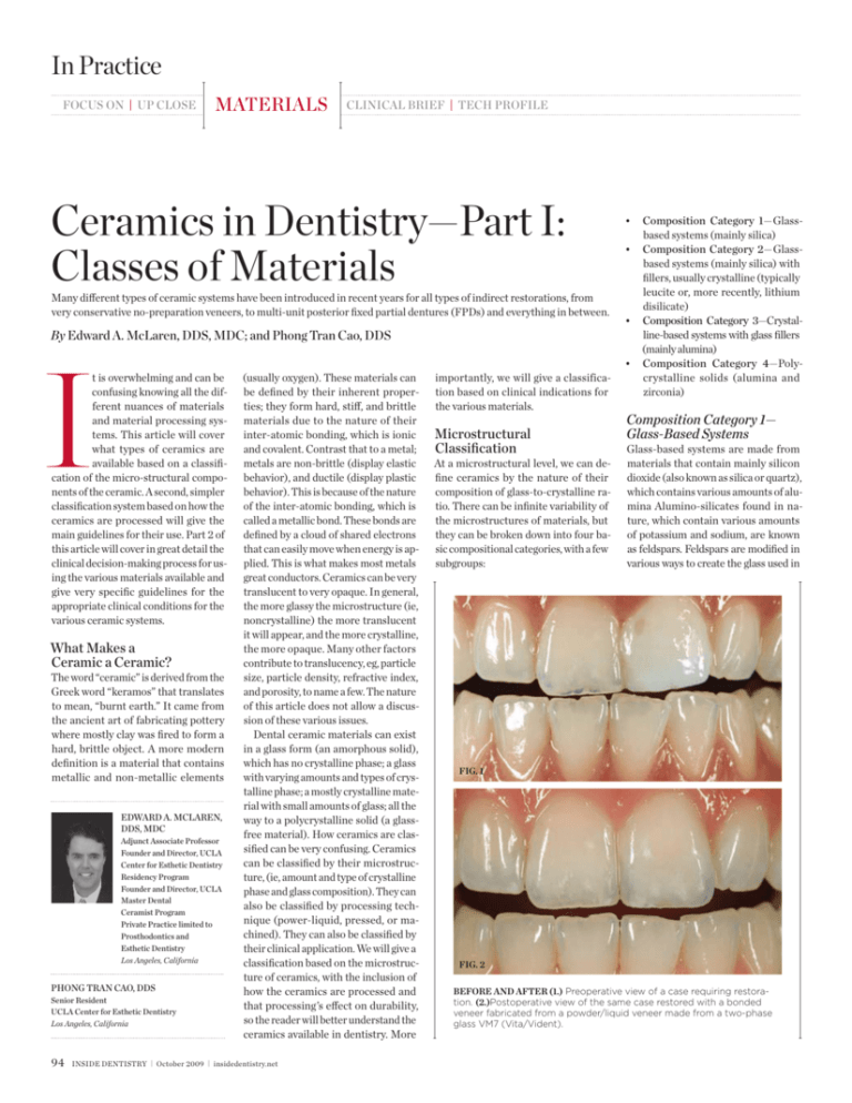 neutral Puno cavity Ceramics in Dentistry—Part I: Classes of Materials