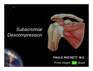 Subacromial Descompression