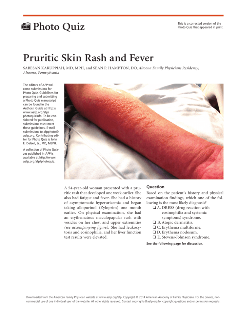 Pruritic Skin Rash And Fever Photo Quiz Cochrane For Clinicians