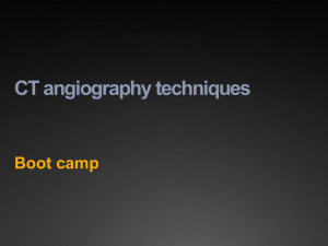 CT angiography techniques