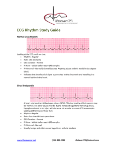 ECG Rhythm Study Guide