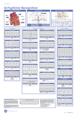 ECG Interpretation Cheat Sheet