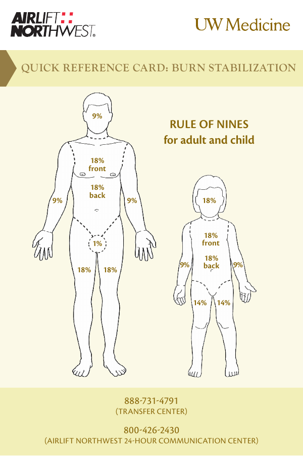 Rule Of Nines Pediatric Burn Chart