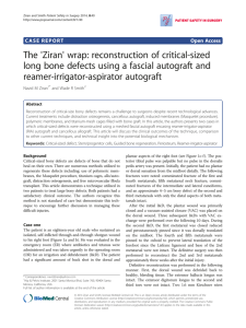 The 'Ziran' wrap: reconstruction of critical