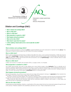 FAQ062 -- Dilation and Curettage (D&C)