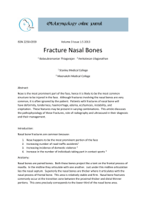 Fracture Nasal Bones