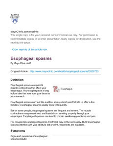 Esophageal spasms - UNC School of Medicine