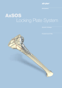 AxSOS Proximal Tibia Operative Technique