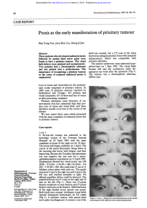 Ptosis as the early manifestation of pituitary tumour