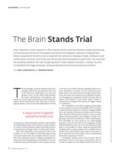 The Brain Stands Trial