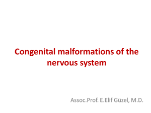 Congenital malformations of the nervous system