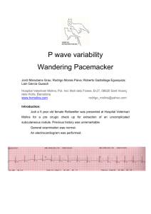 P wave variability Wandering Pacemacker