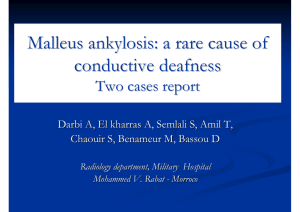 Malleus ankylosis: a rare cause of conductive deafness