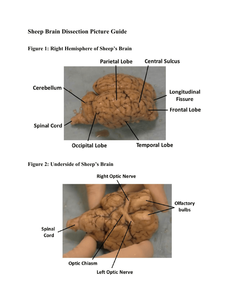Sheep Brain Dissection Picture Guide In Sheep Brain Dissection Worksheet