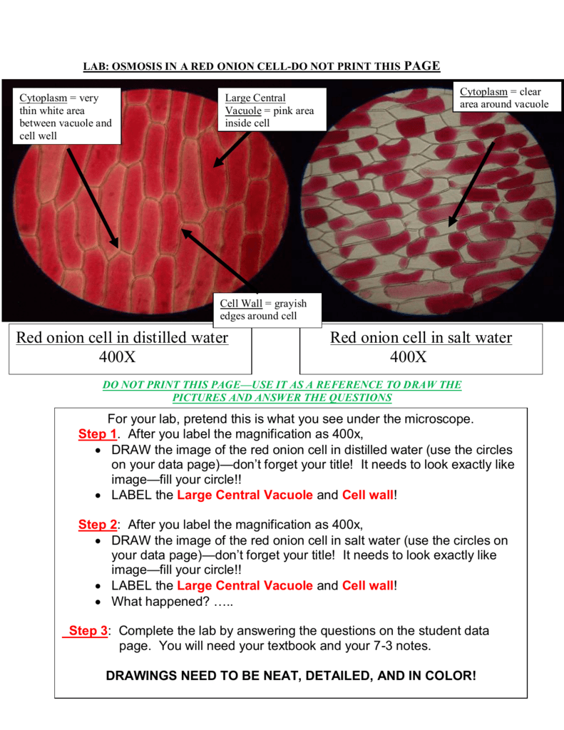 red onion cell lab report