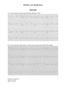 Handout - Torrey EKG