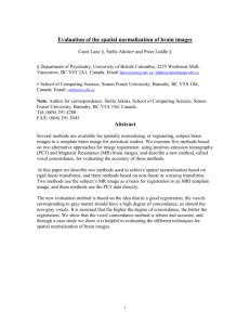 Evaluation of the spatial normalization of brain images