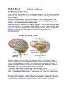 The Brain - U