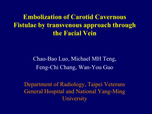 Embolization of Carotid Cavernous Fistulae by transvenous