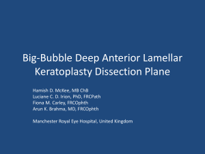 Big-Bubble Deep Anterior Lamellar Keratoplasty Dissection Plane