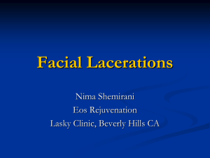 Facial Lacerations - UCLA Head and Neck Surgery