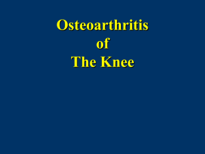 Osteoarthritis of The Knee
