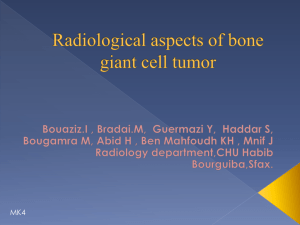 Radiological aspects of bone giant cell tumor
