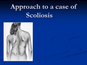 approach to a case of scoliosis