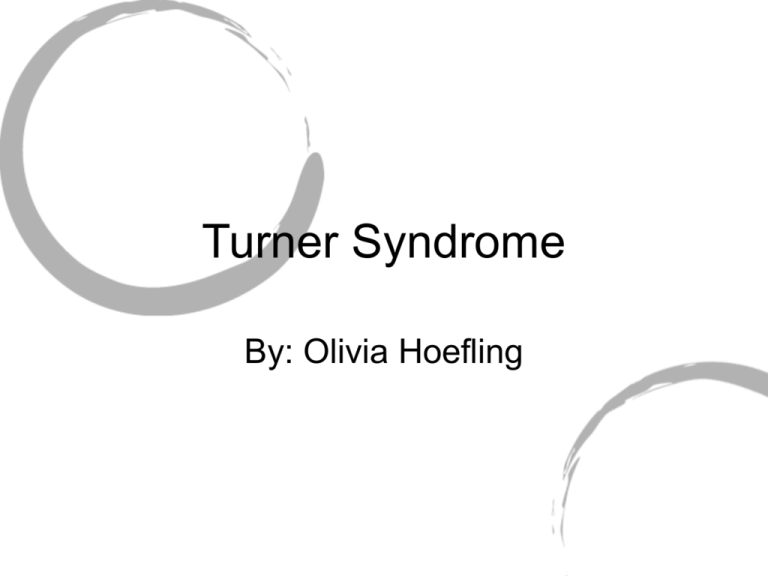 Turner Syndrome Turner Syndrome
