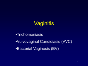 Vaginitis PowerPoint