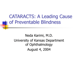 cataracts - Higiene Ocupacional