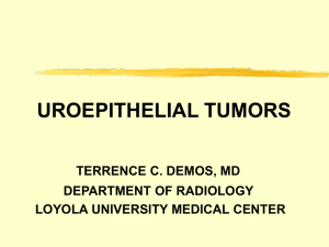 UROEPITHELIAL TUMORS - Loyola University Medical Education