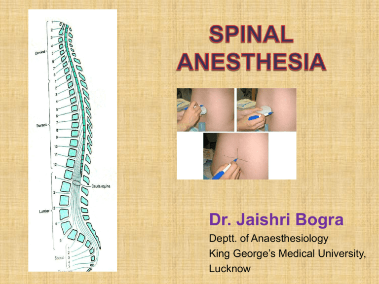 thesis topics on spinal anaesthesia
