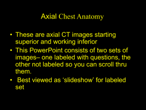 Chest - Radiology