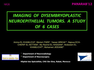 imaging of dysembryoplastic neuroepithelial tumors. a study of 6 cases