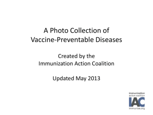 Vaccine-Preventable Diseases - Immunization Action Coalition