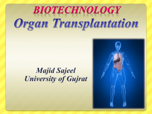 Organ Transplantation