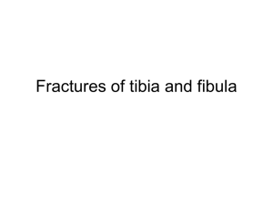 Fractures of tibia and fibula