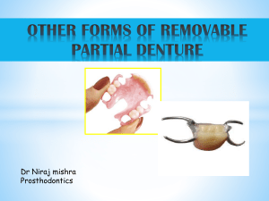 other forms of removable partial denture [ppt]