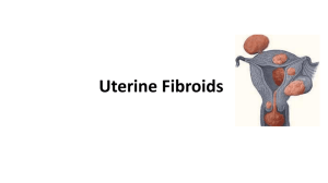 Fibroid Presentation [PPT]