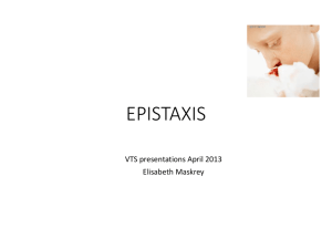 epistaxis - Barnsley VTS